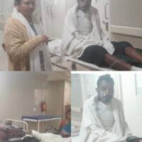 डायन के संदेह में पत्नी , बेटा सहित पति को पेट्रोल डालकर जलाया गया, मां बेटे की मौत , पति एमजीएम अस्पताल में भर्ती…..